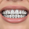 Diamond Grillz Full Smile View